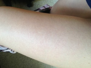 Although my thigh was hit just as hard as my shin in the accident, as you can see no bruising 18 hours later !!  :)